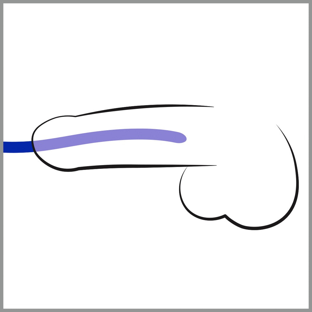 Toyz4Lovers Urethral Dilators Kit – Σετ 3 Ουρηθρικών Διαστολέων (Sounds) - Image 2